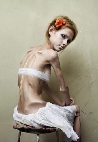 bulimia-anorexia.jpg rock hard picture by mantusmania