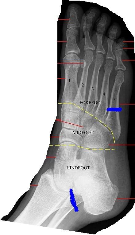 foot-1.jpg